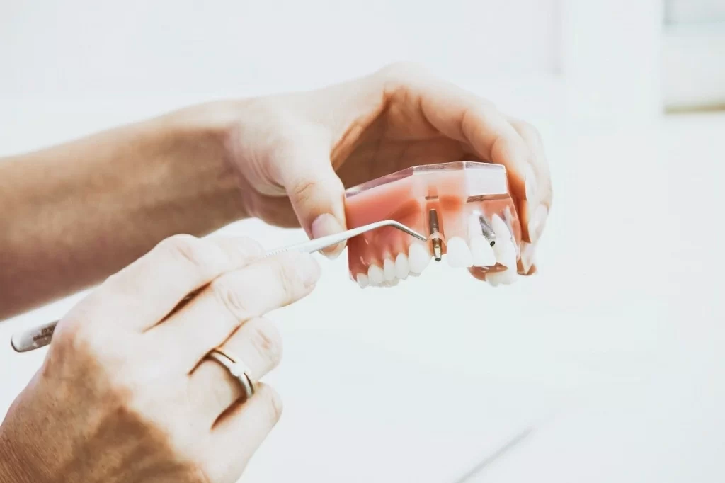 Протезирование зубов при полном отсутствии
