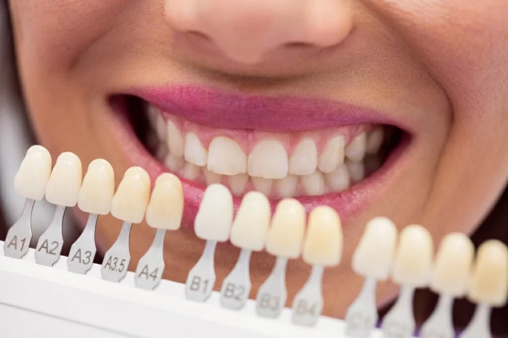 Несъемные зубные протезы: виды и особенности