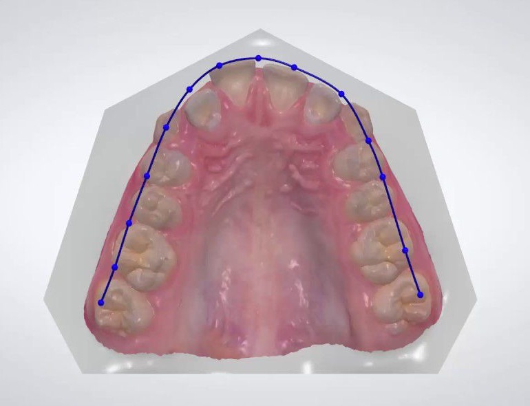 Биометрические методы исследования в ортодонтии